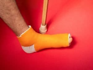 Hiking With A Broken Toe (Care & Prevention Guide)